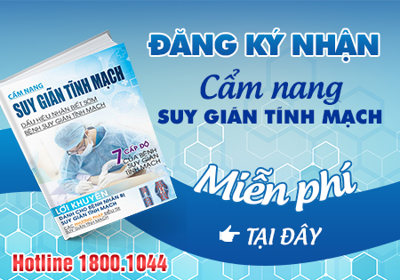 Cẩm nang suy giãn tĩnh mạch