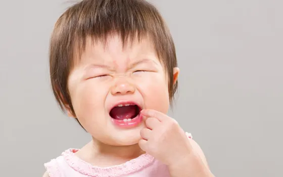 Bé bị biếng ăn sinh lý do mọc răng