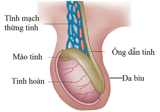 Bệnh lý suy giãn tĩnh mạch thừng tinh