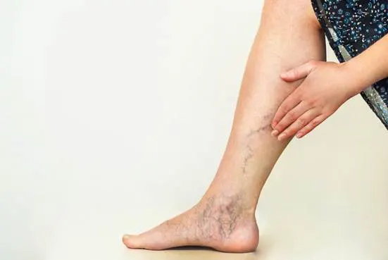 Hình ảnh thường gặp ở người bệnh suy giãn tĩnh mạch chân