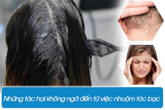 Tác hại khôn lường do thuốc nhuộm tóc gây ra là gì?