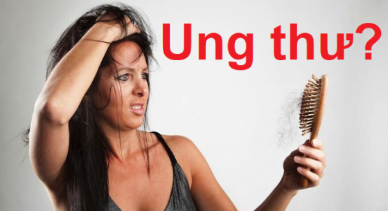 Rụng tóc nhiều có phải bị ung thư không?