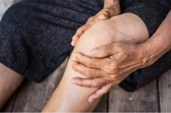 Đau chân là triệu chứng điển hình của bệnh suy giãn tĩnh mạch