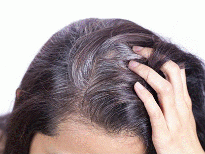 Tóc bạc sớm là tình trạng như thế nào?