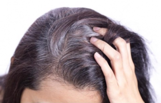 Tóc bạc nên nhuộm màu gì? Có cách nào khác ngăn ngừa bạc tóc không?