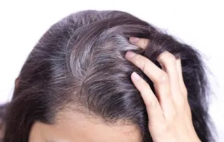 Tóc bạc nên nhuộm màu gì? Có cách nào khác ngăn ngừa bạc tóc không?