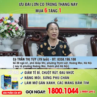 Suy giãn tĩnh mạch: Cứ nổi mạch to ngoằn ngoèo là bệnh nặng?