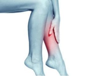 Hỏi: Tôi bị suy giãn tĩnh mạch có tập thể dục được không?