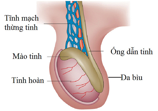 Bệnh lý suy giãn tĩnh mạch thừng tinh