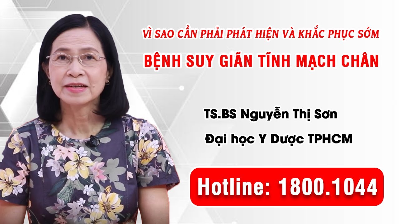 BoniVein - Vì sao cần phải phát hiện và khắc phục bệnh suy giãn tĩnh mạch chân