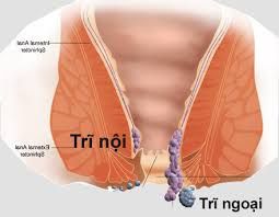 Hỏi: Dùng BoniVein trị trĩ bao lâu có tác dụng?